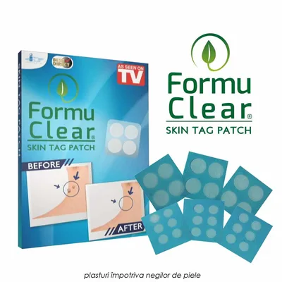 FormuClear Skin Tag Patch - plasturi impotriva negilor de piele skit30L